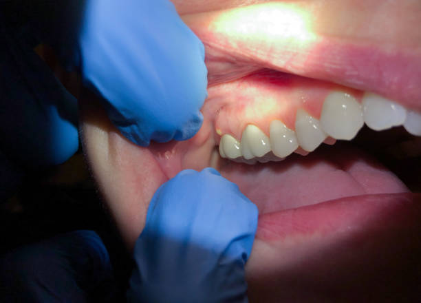 Best Emergency Dentist for Knocked-Out Tooth in Kotlik, AK
